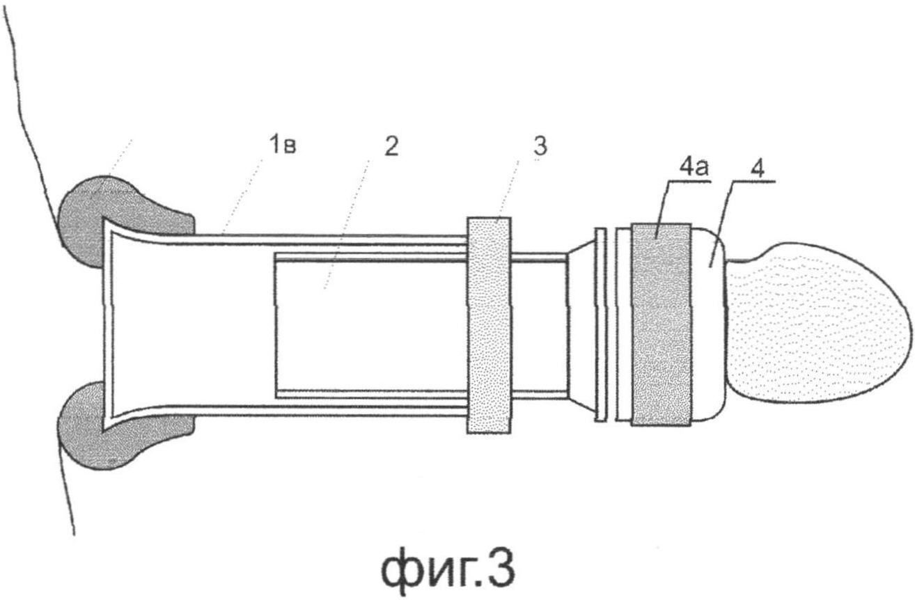ЦИЛИНДРИЧЕСКИЙ ЭКСТЕНДЕР ПЕНИСА. Патент № RU 2565808 МПК A61H19/00 | Биржа  патентов - Московский инновационный кластер