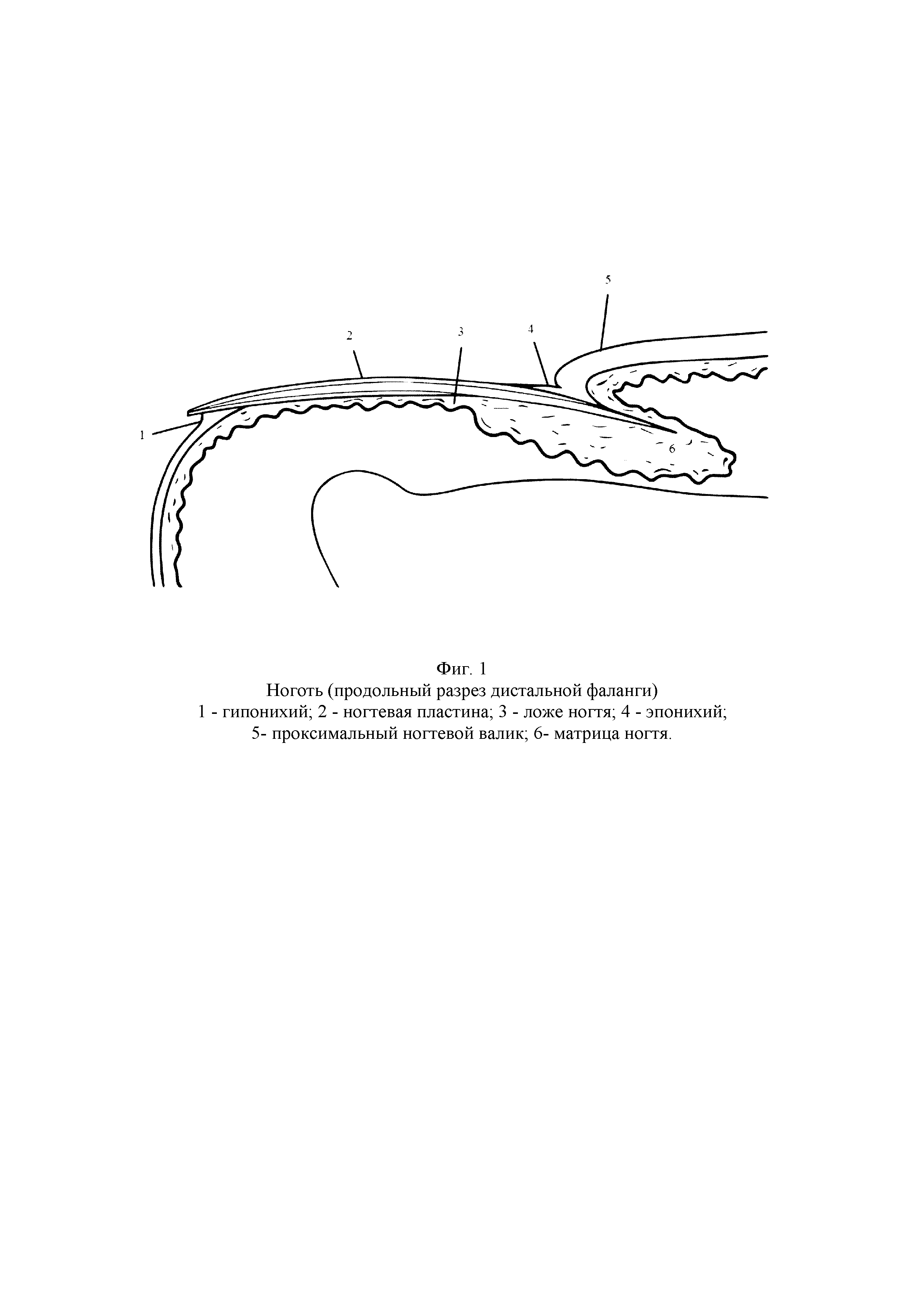 СПОСОБ ОПЕРАТИВНОГО ЛЕЧЕНИЯ ВРОСШЕГО НОГТЯ. Патент № RU 2761411 МПК  A61B17/00 | Биржа патентов - Московский инновационный кластер