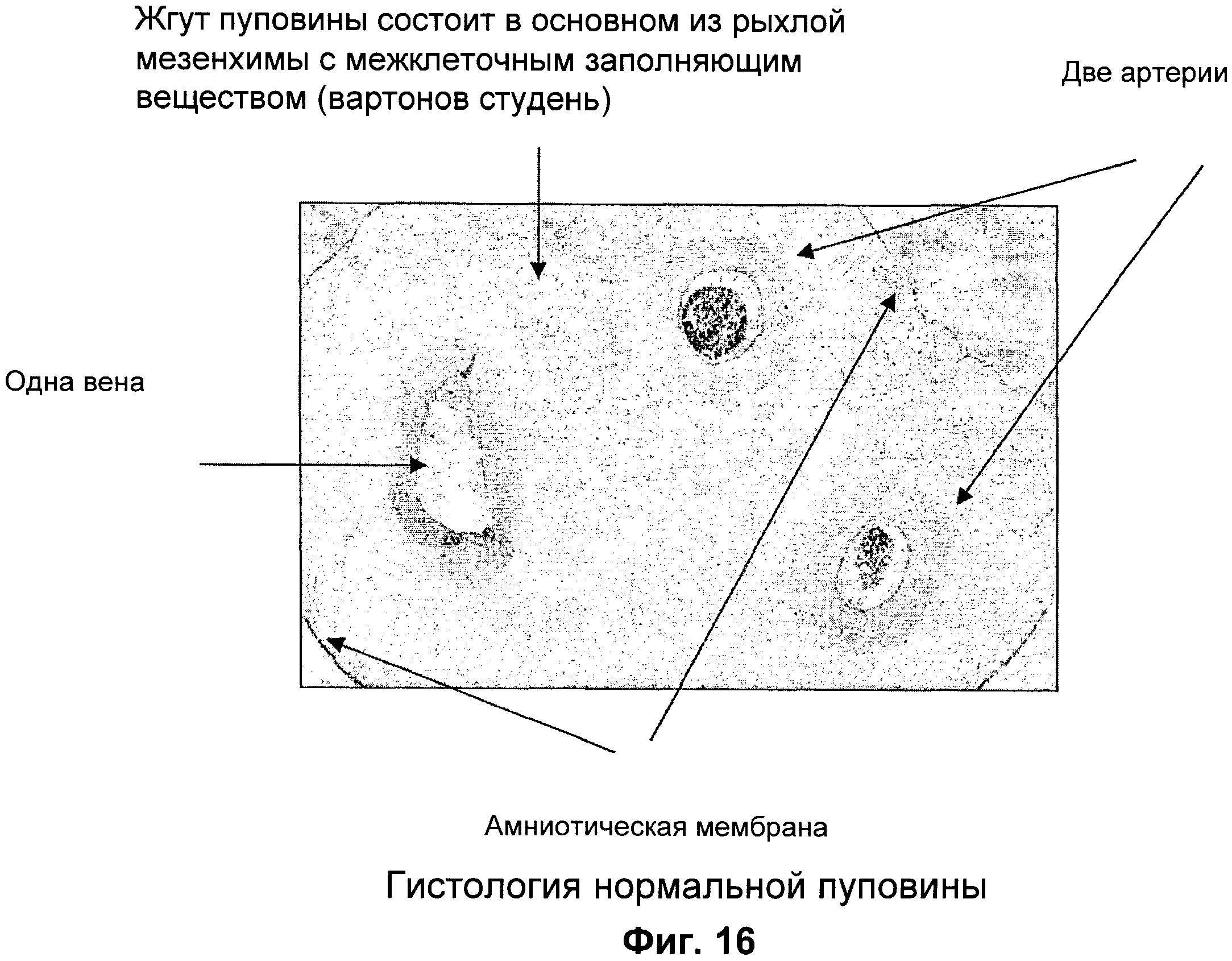 ВЫДЕЛЕНИЕ СТВОЛОВЫХ КЛЕТОК/КЛЕТОК-ПРЕДШЕСТВЕННИКОВ ИЗ АМНИОТИЧЕСКОЙ  МЕМБРАНЫ ПУПОВИНЫ. Патент № RU 2416638 МПК C12N5/0789 | Биржа патентов -  Московский инновационный кластер