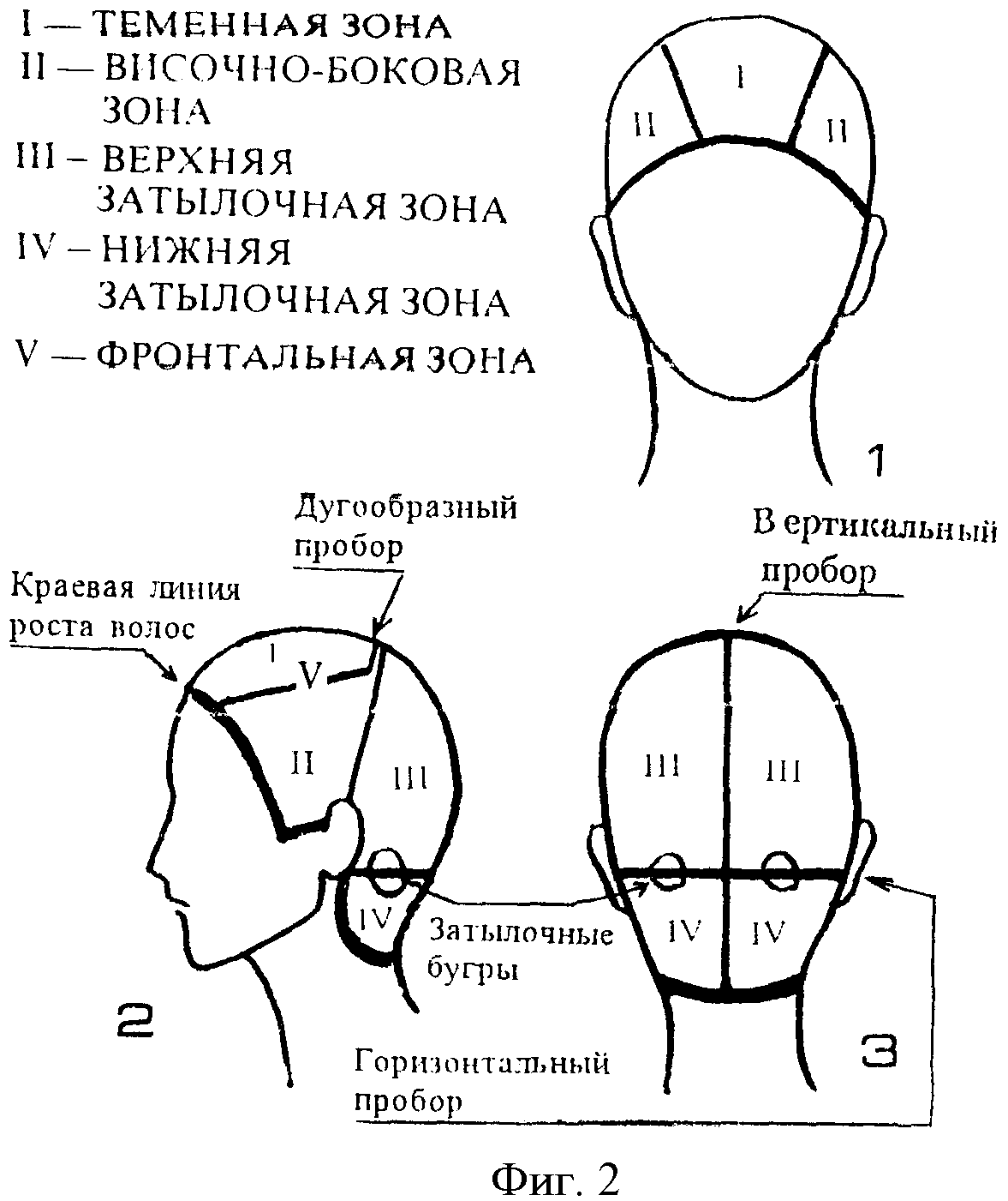 Где теменная область