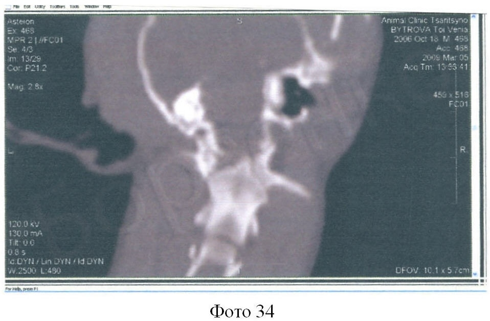 Различия между рентгенографией и магнитно-резонансной томографией