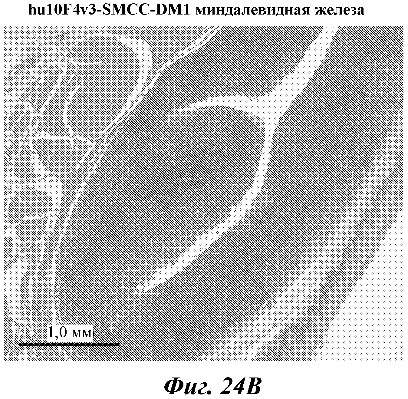 АНТИТЕЛА И ИММУНОКОНЪЮГАТЫ И ИХ ПРИМЕНЕНИЯ. Патент № RU 2436796 МПК  A61K39/295 | Биржа патентов - Московский инновационный кластер