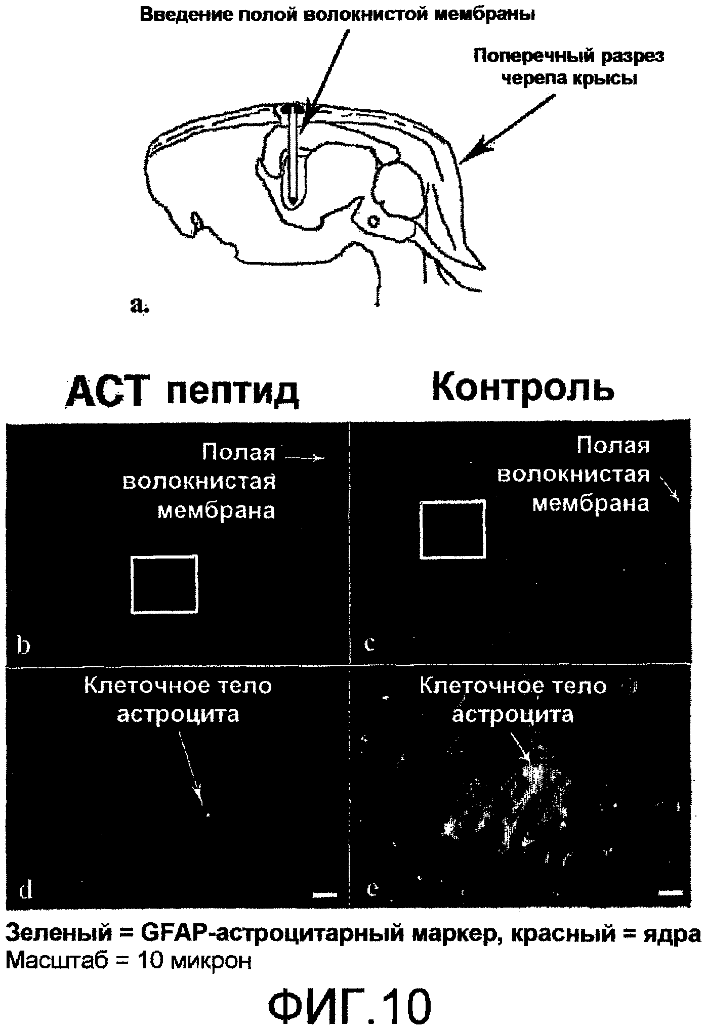 Сокращение затрат на повязочные материалы