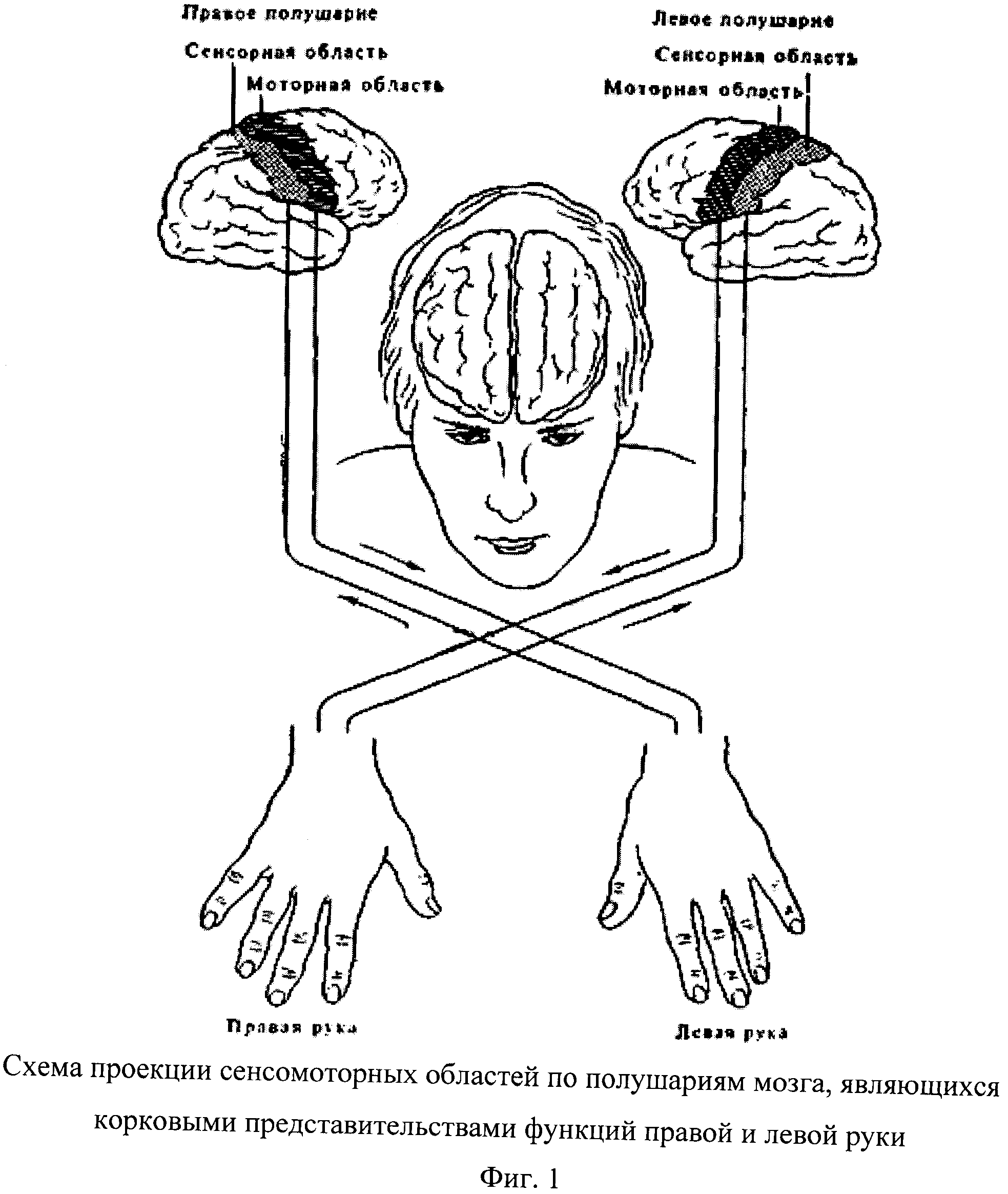 Левое полушарие какая рука. Функциональная межполушарная асимметрия головного мозга это. ЭЭГ-проявления функциональной межполушарной асимметрии мозга. Функциональная асимметрия мозга схема. Функциональная асимметрия: сенсорная, моторная.