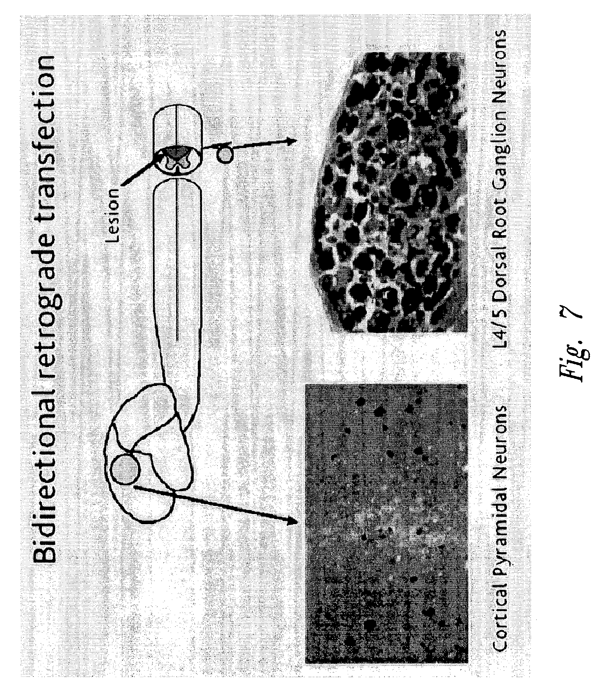 Devices containing DNA encoding neurotrophic agents and related  compositions and methods. Патент № US 20040138155 МПК A61K48/00 | Биржа  патентов - Московский инновационный кластер