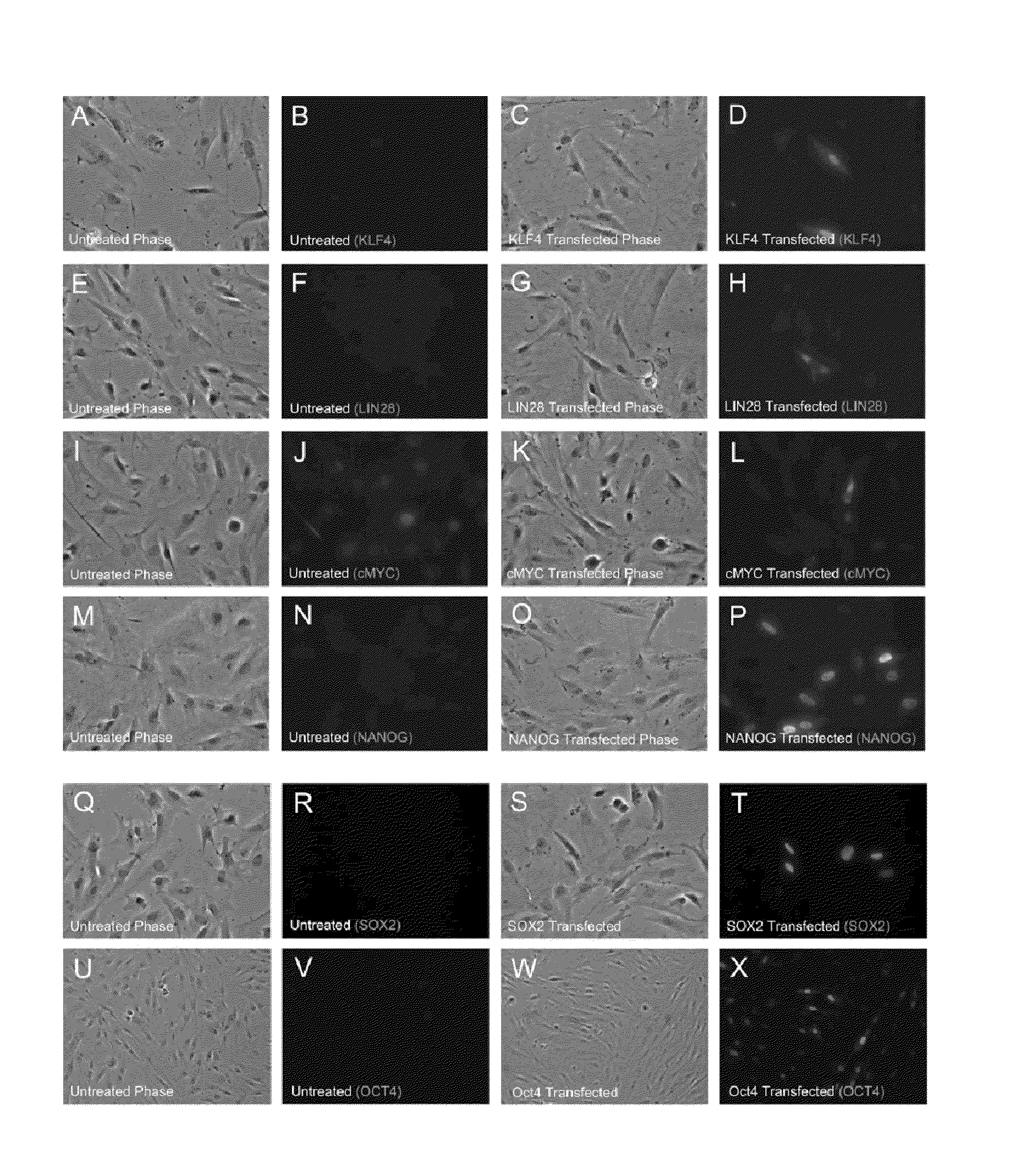 RNA PREPARATIONS COMPRISING PURIFIED MODIFIED RNA FOR