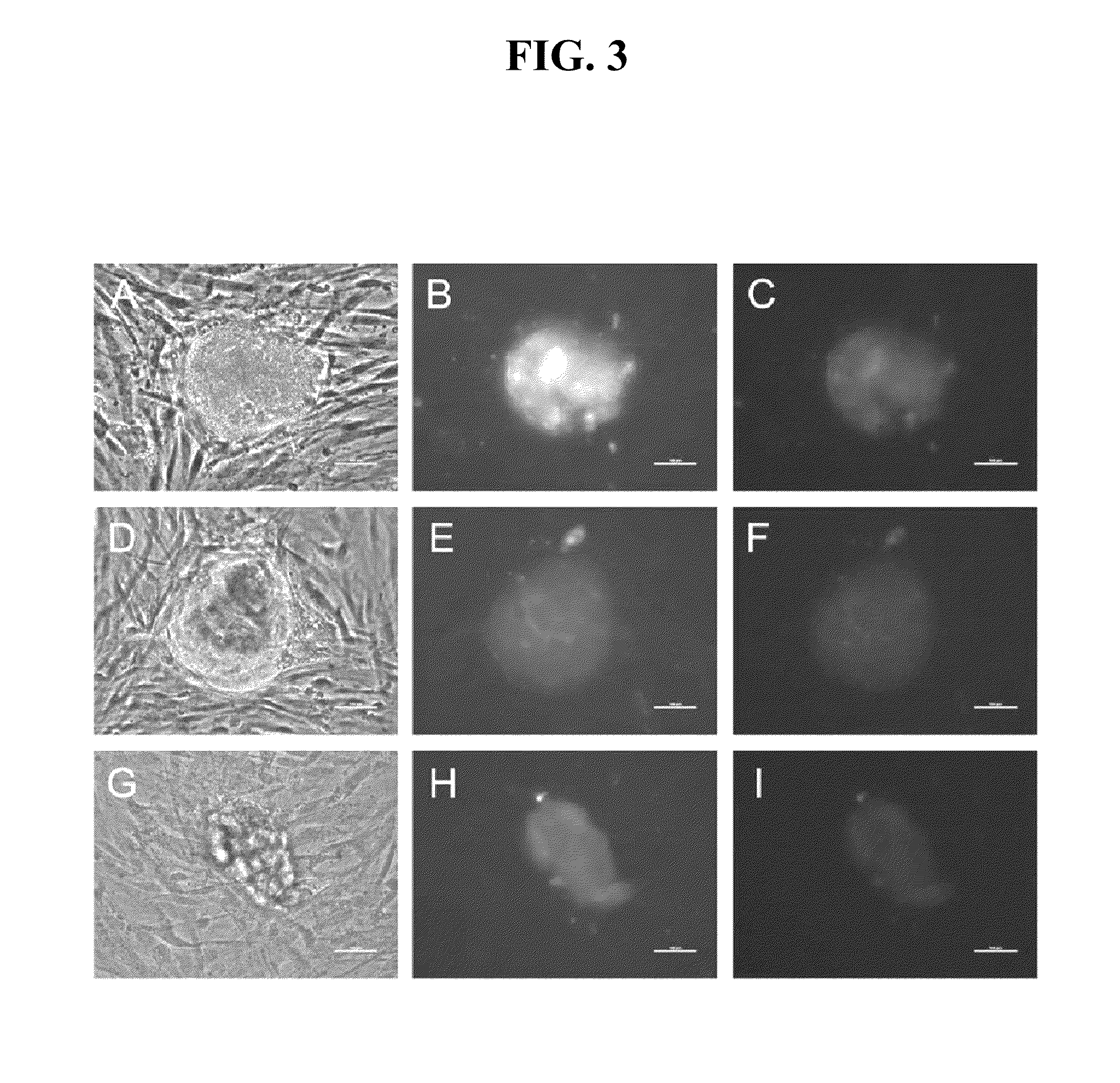 RNA PREPARATIONS COMPRISING PURIFIED MODIFIED RNA FOR