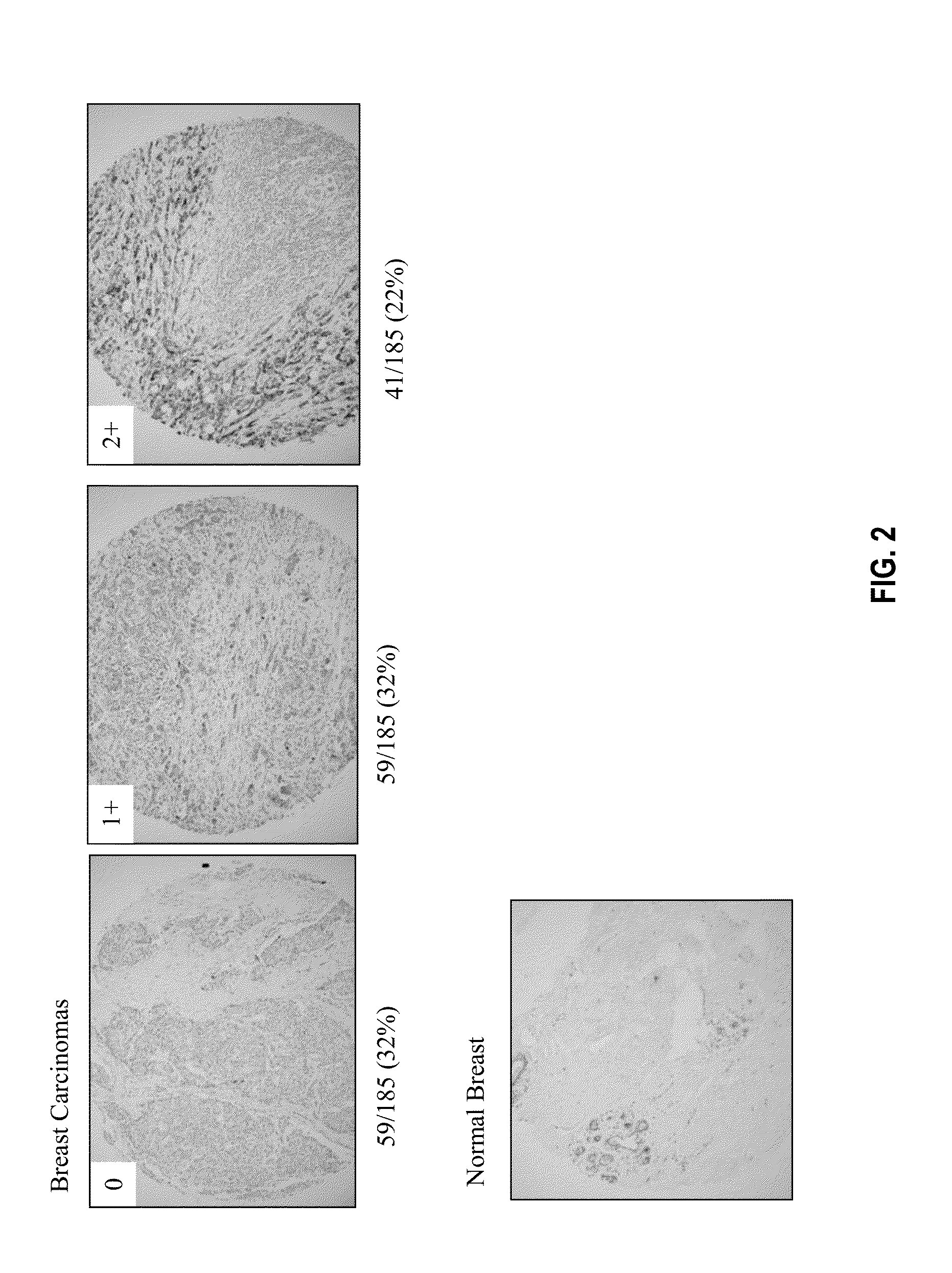 ANTI-B7-H4 ANTIBODIES AND IMMUNOCONJUGATES. Патент № US 20160159910 МПК  C07K16/28 | Биржа патентов - Московский инновационный кластер